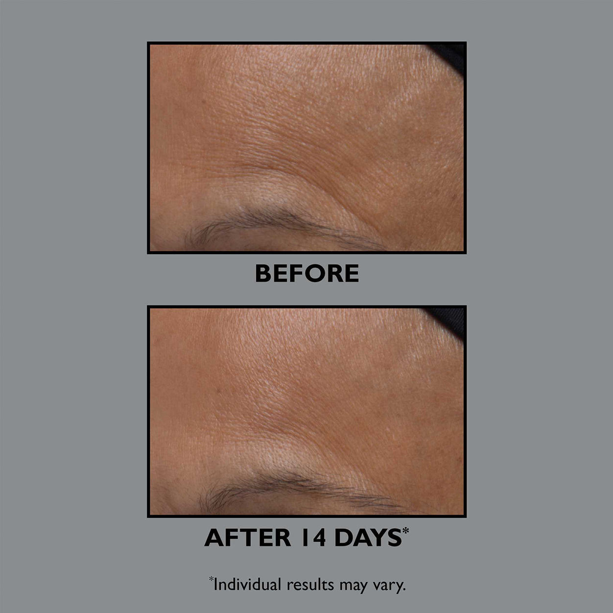 FIRMx Collagen Moisturizer Cream - Anti-Aging Face Moisturizer with Hyaluronic Acid & Vitamin E - Deep Hydration for Dry, Sensitive Skin - Day & Night Cream for Women & Men - Perfect for Daily Skincare Routine & Travel