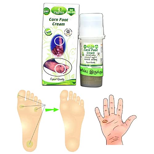 Zigma Ointment for Kaal Aani - Effective Foot Corn Remover, Hand Corn Treatment & Callus Removal Cream (500mg) | Fast Relief for Corns, Calluses & Kapasi - Perfect for Daily Foot Care & Hand Care Routine