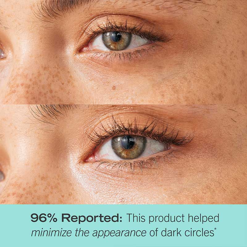 First Aid Beauty Brighten + Glow Eye Cream with Niacinamide - Dark Circle Treatment & Puffiness Reduction - Perfect for Morning & Night Skincare Routine