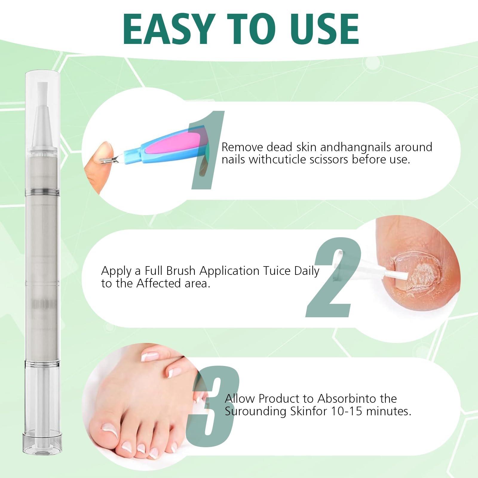 5-Piece Supplend Nail Care Pen Set with Tea Tree Oil - Fast & Intensive Nail Treatment for Dry, Damaged Cuticles - Perfect for Home Manicures & Salon Use