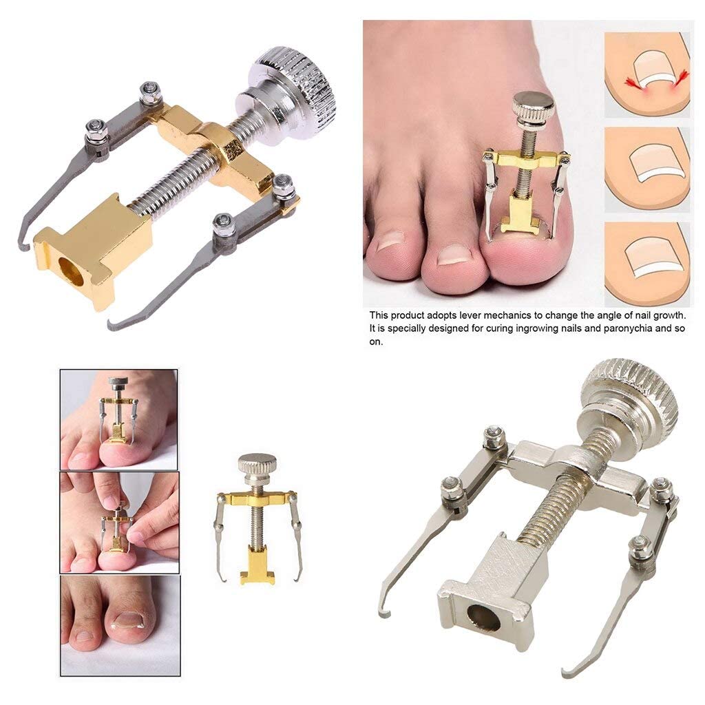 2 Pack Ingrown Toenail Corrector Tools - Professional Toenail Correction Kit for Pain Relief & Nail Care - Perfect for Home Pedicure & Foot Health Maintenance