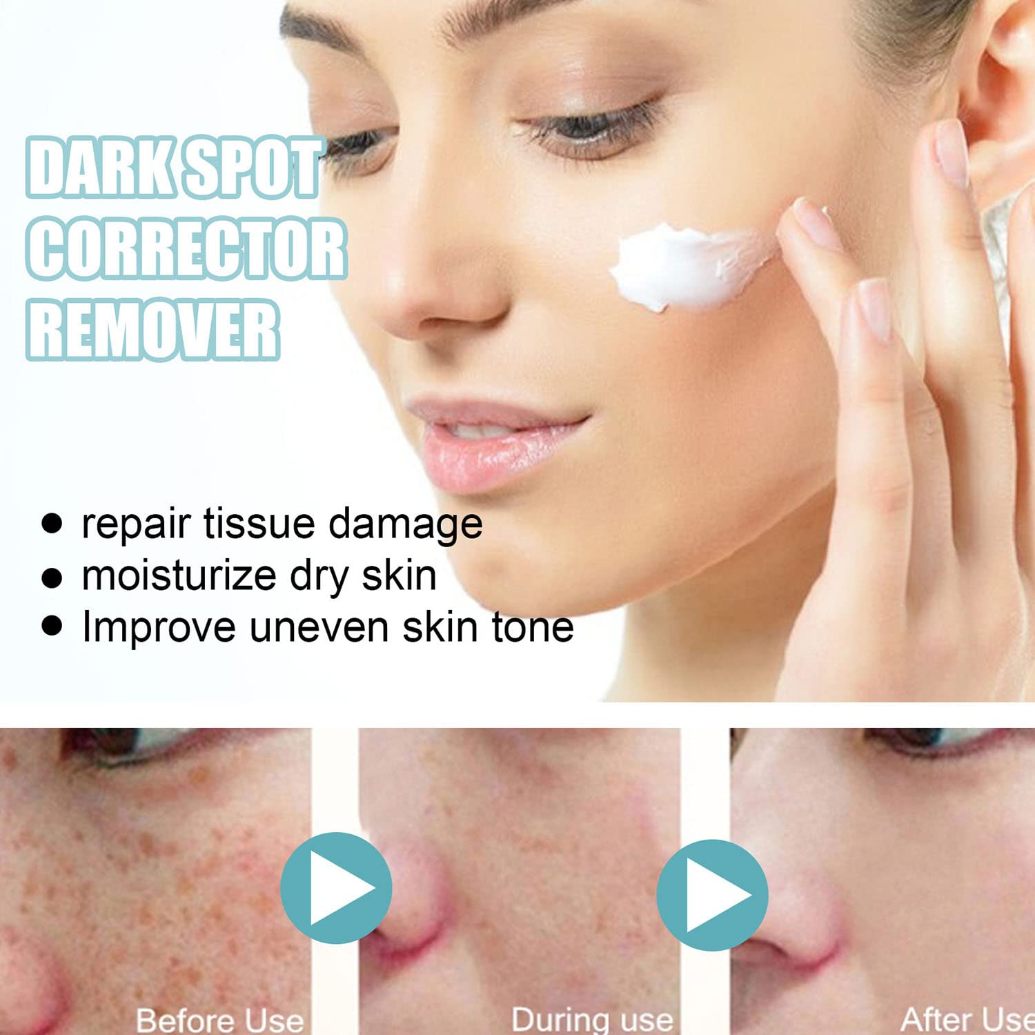 Tkekruh Spot Cream - Dark Spot Remover & Brightening Face Cream for Pigmentation, Blemishes & Uneven Skin Tone | Improves Complexion for Radiant Skin | Perfect for Daily Skincare & Nighttime Use