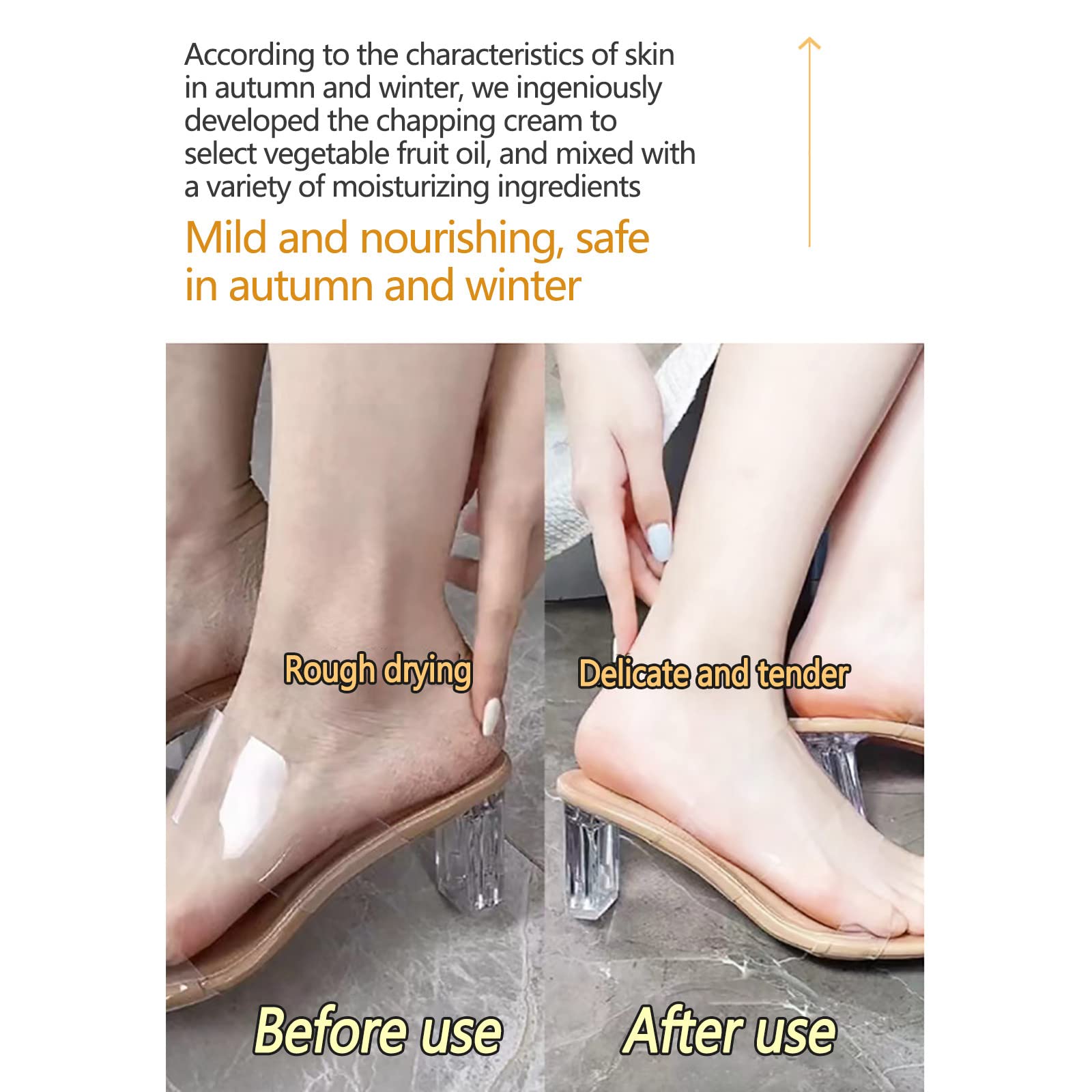 Natural Cracked Skin Repair Cream for Hands & Feet - 100% Organic Winter Anti-Cracking Moisturizer, Heel Balm for Dry Cracked Skin - Best for Winter Care, Dry Skin Relief & Foot Crack Treatment - Perfect for Dry Weather, Harsh Winters & Daily Foot Care Routine