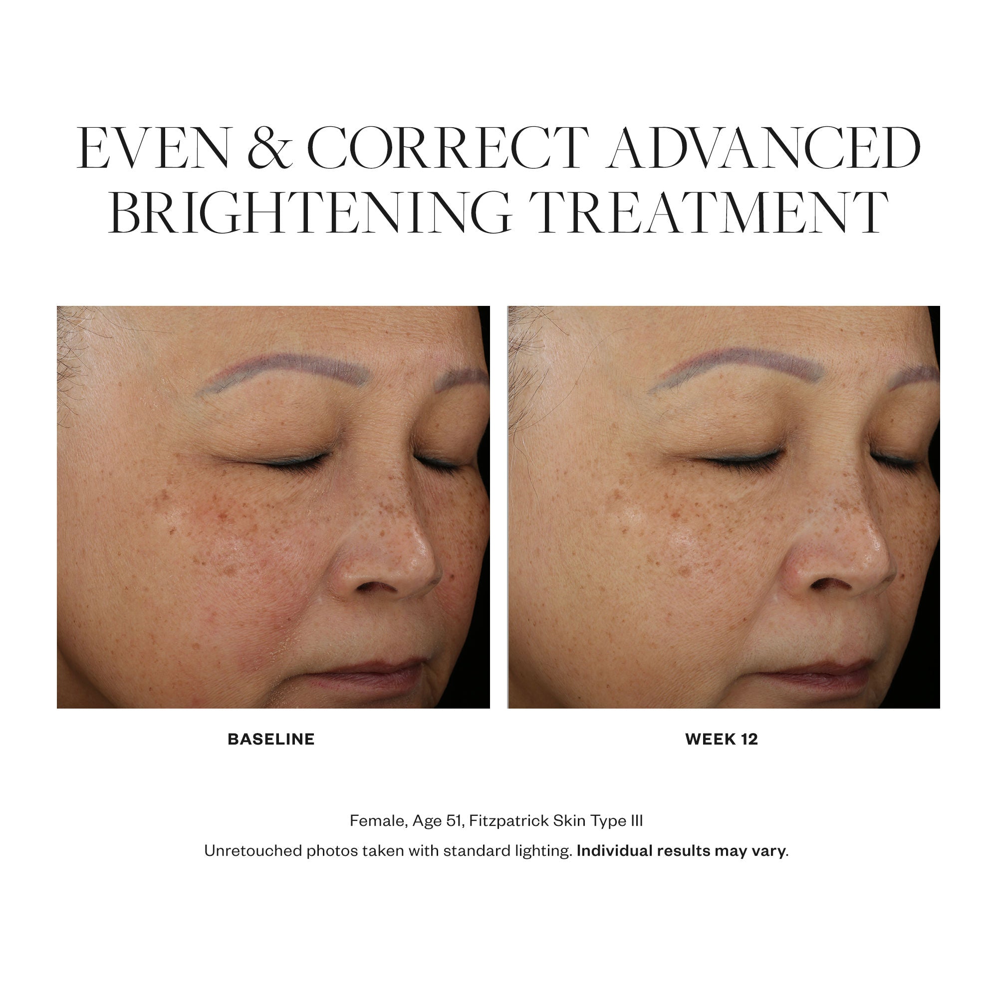 Even & Correct Advanced Brightening Treatment - Skin Brightening Cream for Dark Spots & Hyperpigmentation - Perfect for Nighttime Skincare Routine & Uneven Skin Tone Correction
