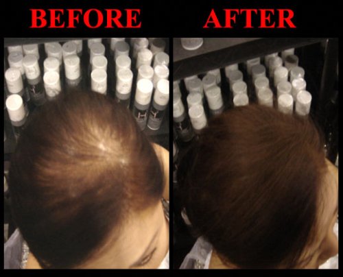 Hair Cubed® Auburn Hair Building Fiber Spray - Waterproof Hair Thickening & Concealing Solution for Thinning Hair - Lasts 2-5 Months - Perfect for Daily Use, Special Occasions & Confidence Boosting