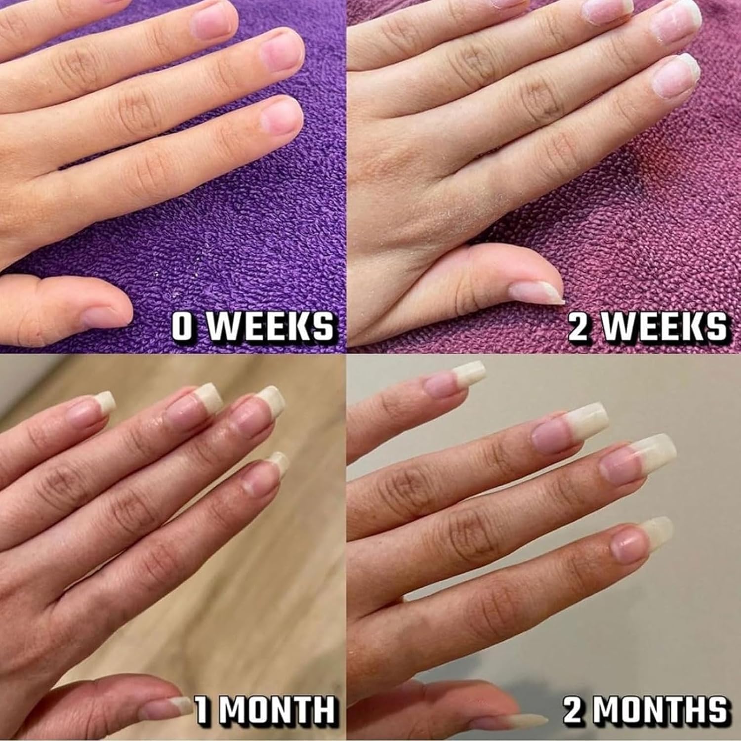 **Brother Cosmetics Nail Growth Oil – 2025 New Formula for Stronger, Healthier Nails | Nail Strengthener & Thickener for Thin Nails | Fast-Acting Treatment for Natural Nail Growth | Perfect for Salon & Home Use**