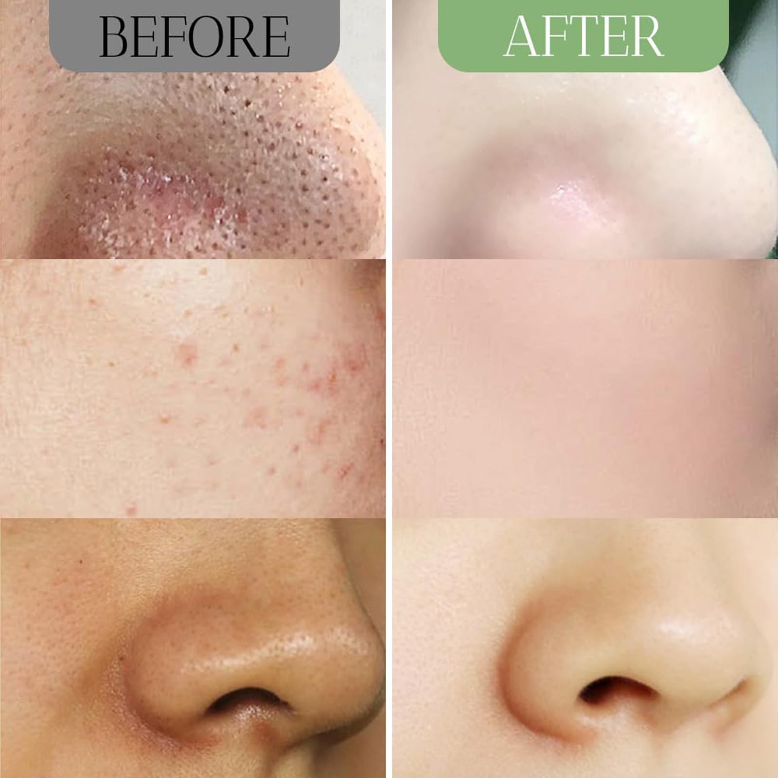Dermaease Green Tea Deep Cleansing Mask Stick - Pore Minimizer & Oil Control for Acne-Prone Skin | Travel-Friendly Skincare for On-the-Go Glow