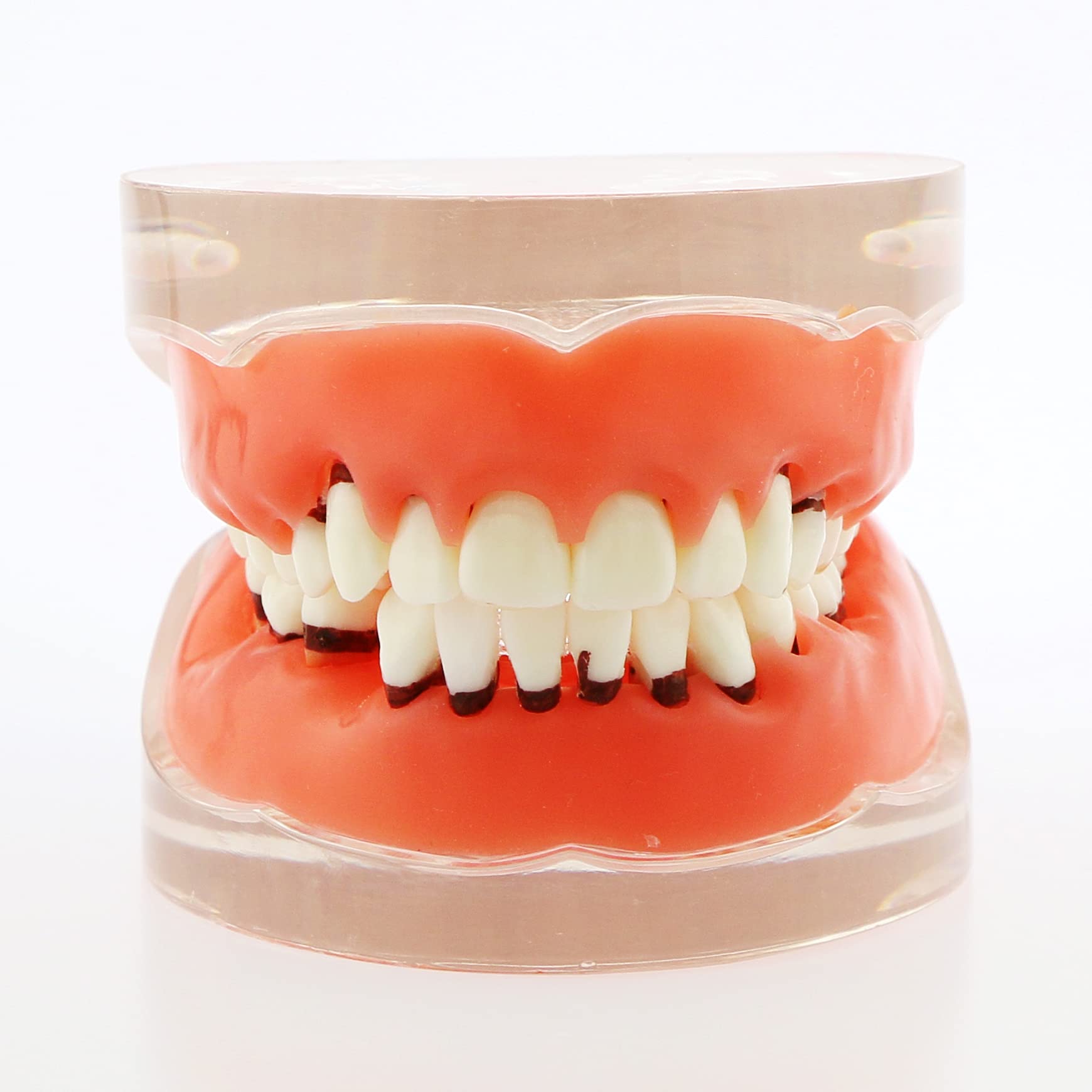 Adult Transparent Dental Teeth Model - Removable Gingivae for Pathology Study & Teaching - Perfect for Dental Students, Dentists & Medical Professionals