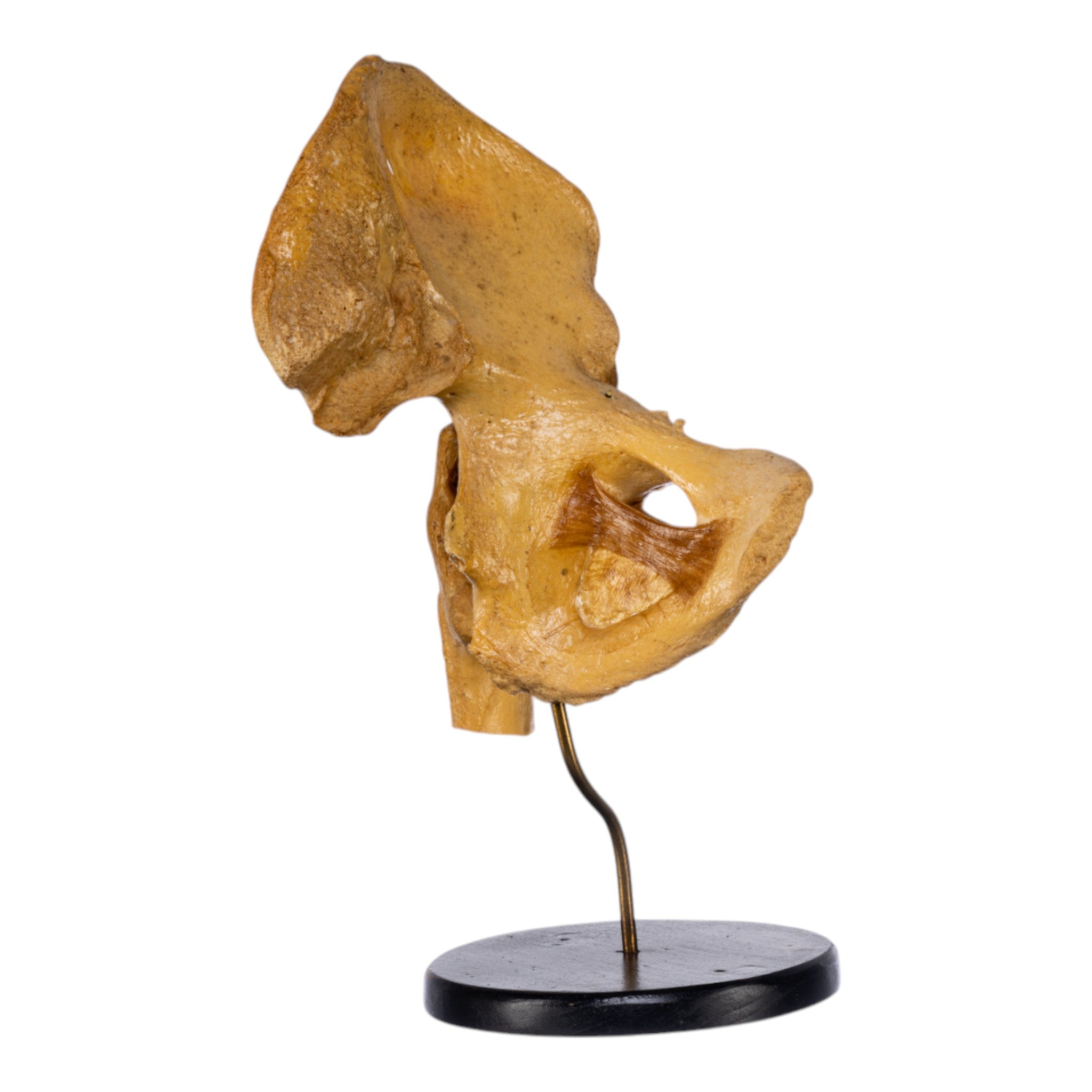 Authentic Human Left Hip Joint Specimen on Display Stand - Ideal for Medical Education, Anatomy Studies & Research