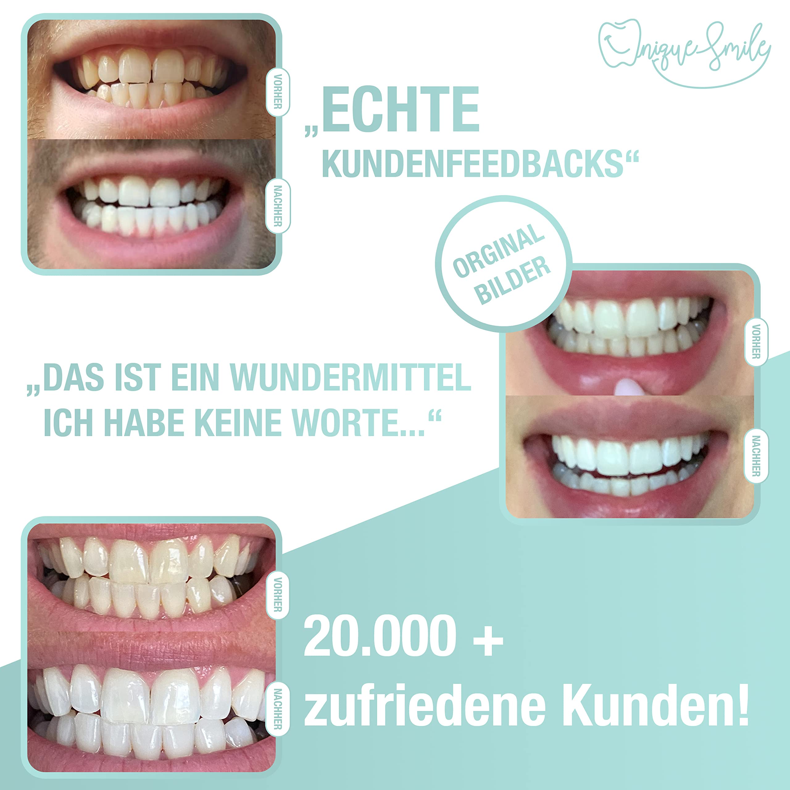 Premium Teeth Whitening Kit by UniqueSmile - Complete All-in-One Bundle for Teeth Whitening & Stain Removal | Professional Dental Bleaching Set (Refill Kit) for Brighter Smile at Home or Travel