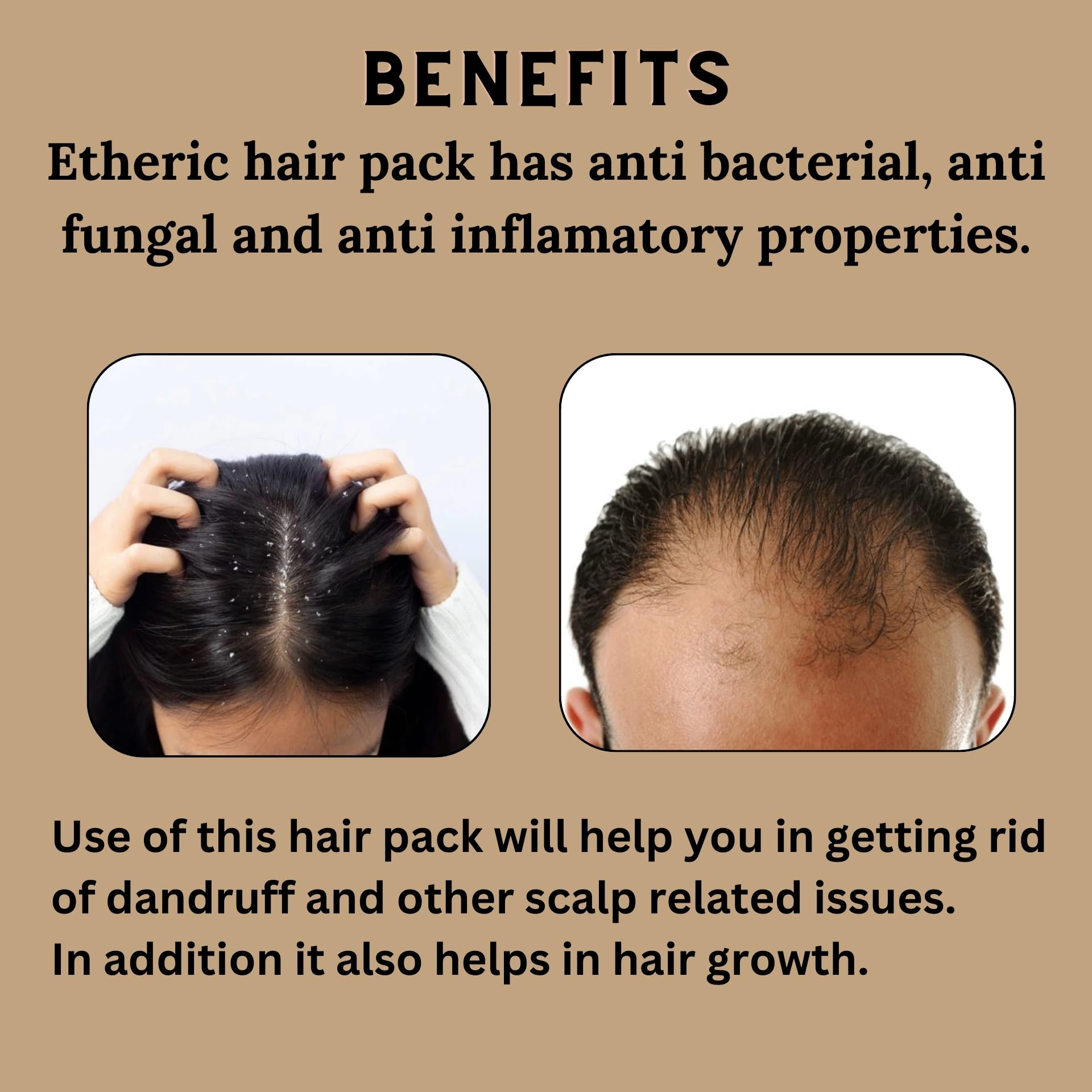 Etheric Anti-Dandruff Hair Treatment Pack - Controls Dandruff & Reduces Hair Fall (150g) | Gentle Scalp Care for Daily Use & Healthy Hair Growth