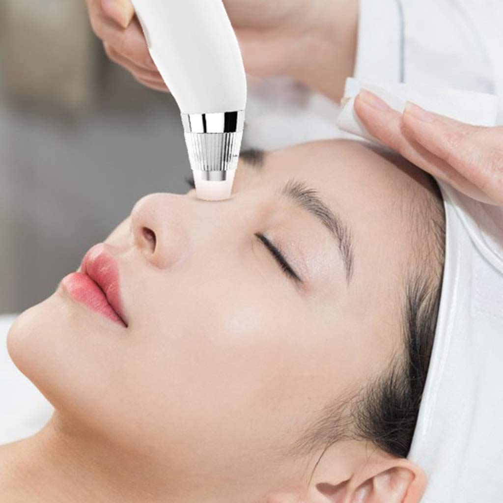 Electric Blackhead Remover & Pore Vacuum Cleaner - USB Rechargeable Acne Extractor with 3 Suction Probes for Face & Nose | Deep Cleansing Facial Tool for Blackheads, Whiteheads & Acne | Perfect for Daily Skincare Routine & Spa Treatments