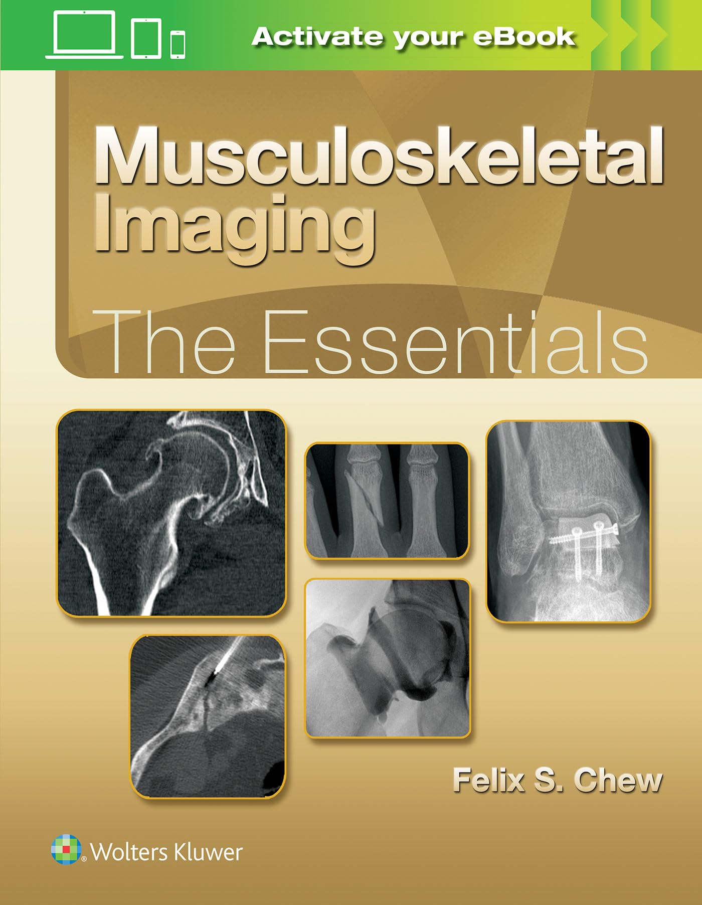 Musculoskeletal Imaging: The Essentials (Essentials Series) - Comprehensive Guide for Radiologists & Medical Students | Perfect for Clinical Practice & Exam Preparation
