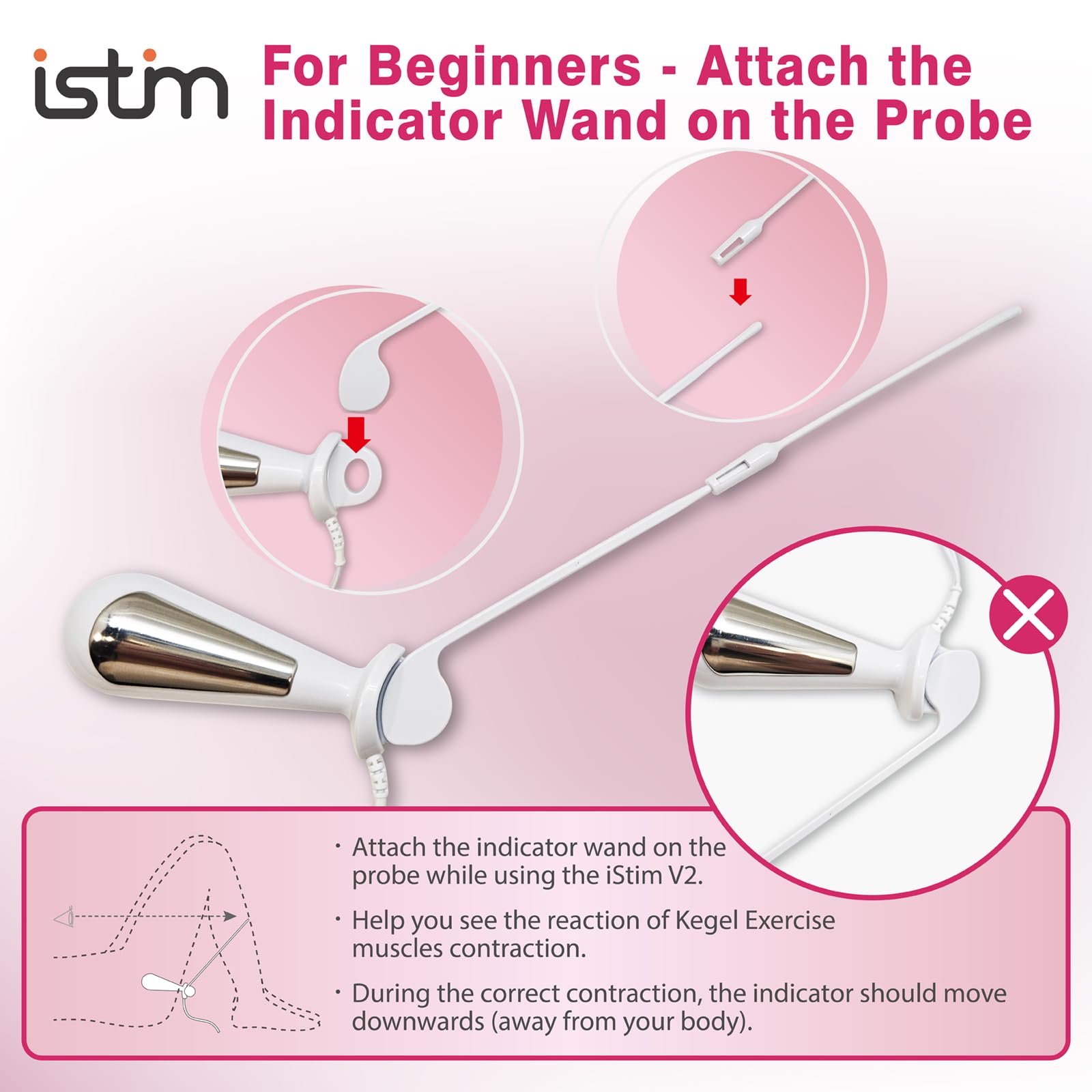 iStim V2 Kegel Exerciser for Women - Pelvic Floor Trainer with EMS Technology for Bladder Control & Incontinence Relief - Includes Probe for Effective Muscle Stimulation - Perfect for Postpartum Recovery & Women's Wellness