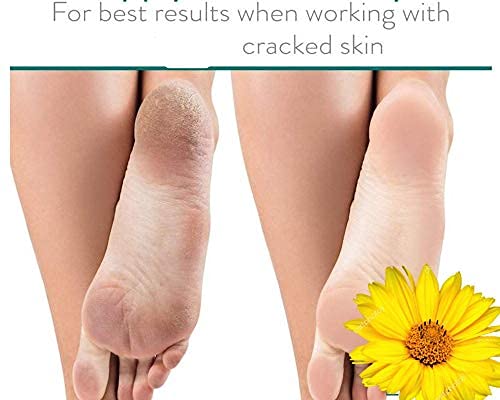 Khadi Rishikesh Herbal Foot Crack Cream - Best Healing & Repair Treatment for Dry, Cracked Heels & Feet | Moisturizing Foot Care Cream for Men & Women | Ideal for Winter Skin Protection | 50GM | Made in India | Perfect for Daily Foot Care & Spa Treatments