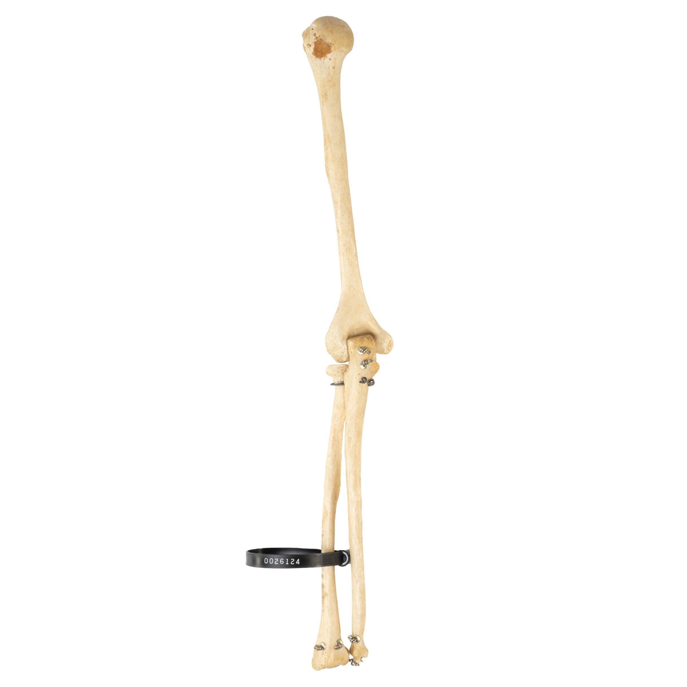 Authentic Human Humerus, Radius & Ulna Bones - Medical Education, Anatomy Study & Science Classroom Specimen