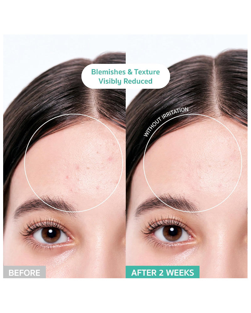 BRING GREEN Tea Tree Cica Soothing Toner for Acne-Prone Skin - Hydrating Facial Toner with Natural Ingredients for Sensitive Skin Care - Perfect for Daily Skincare Routine & Post-Workout Refreshment