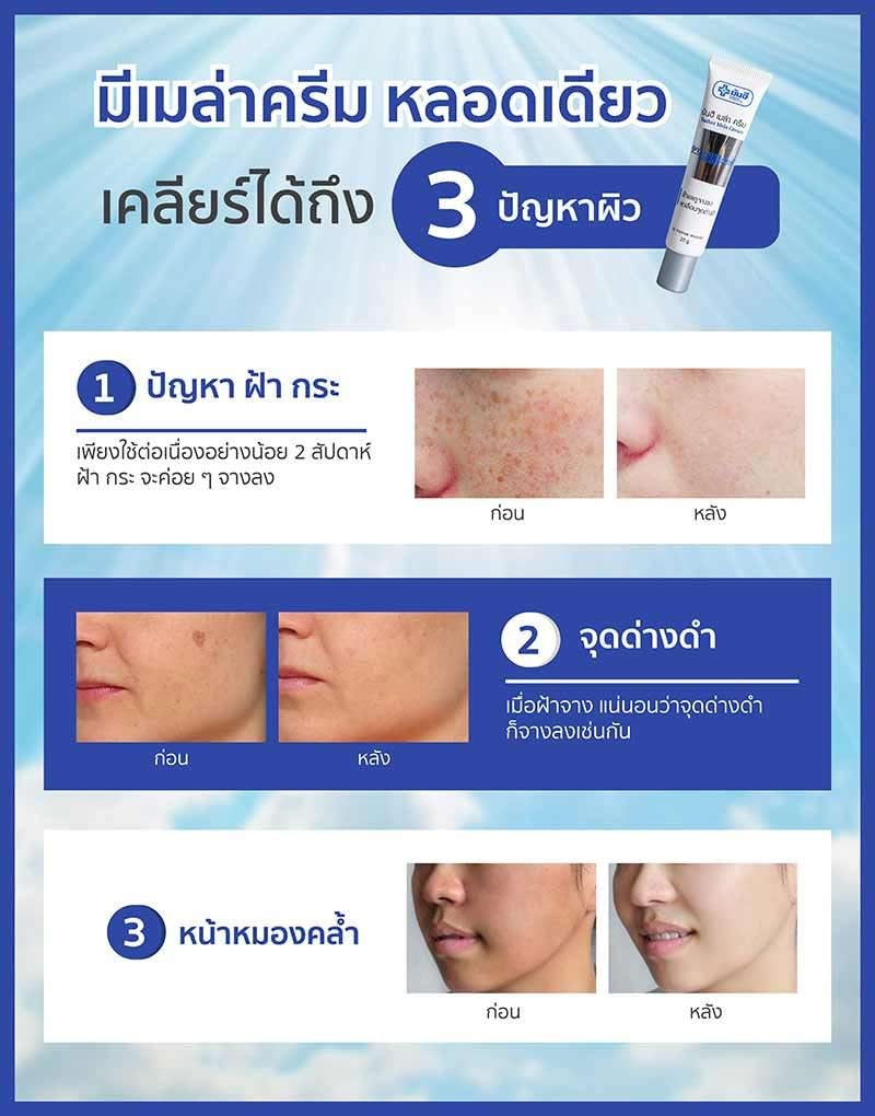 Yanhee Mela Cream for Melasma Treatment - 7g Travel Size (6 Sachets) - Brightening Face Cream for Dark Spots & Hyperpigmentation - Perfect for On-the-Go Skincare & Travel Essentials