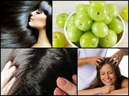 KHADI RISHIKESH Ayurvedic Amla Hair Oil for Hair Growth & Fall Control - 210ml | Promotes Long Strong Hair for Women & Men | Free Keychain Included | Perfect for Daily Hair Care & Scalp Massage