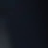 BLACK (GBA)