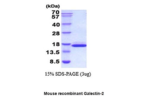 Galectin-2 Mouse Recombinant Protein (10μg) - BioVision Inc - for Immunoassays & Cell Signaling Research