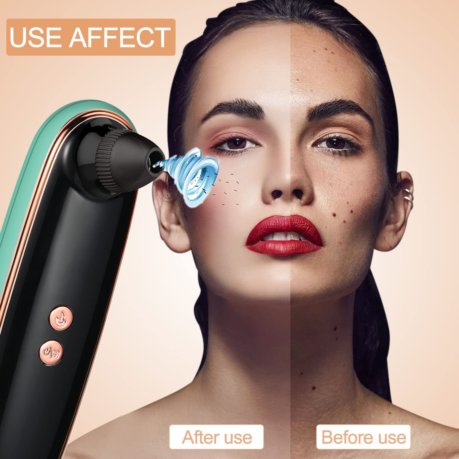 Blackhead Remover Vacuum - Deep Pore Cleanser for Face & Nose - Professional Skin Care Tool for Acne & Blackhead Removal - Perfect for Daily Skincare Routine & Spa Days