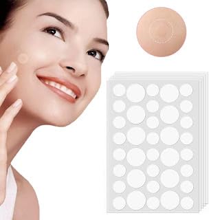 SSM Mart Hydrocolloid Acne Pimple Patches for Face - Spot Treatment Stickers for Blemishes & Breakouts | Calms & Relieves Acne Fast | Perfect for Overnight Use, Travel & Daily Skincare Routine