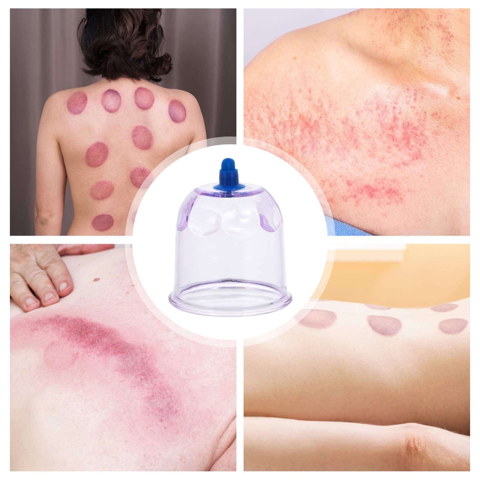 Chinese Cupping Massage Set - Plastic Anti Cup Vacuum Suction Massager for Trigger Point, Myofascial Release & Deep Tissue Therapy | Body Pain Relief, Muscle Relaxation | Perfect for Home Spa, Physical Therapy & Sports Recovery