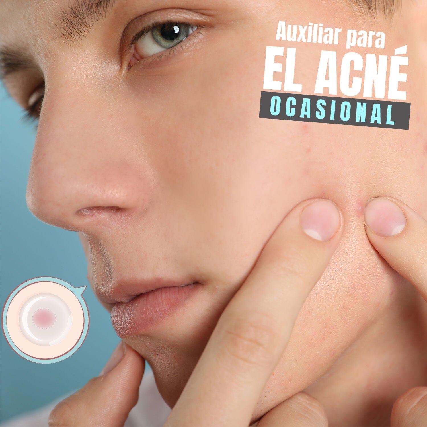 **36pcs Acne Pimple Patches for Men - Clear & Fast Healing Spot Treatment | Republic Cosmetics Skin Care | Perfect for Overnight Use & Daily Skincare Routine**