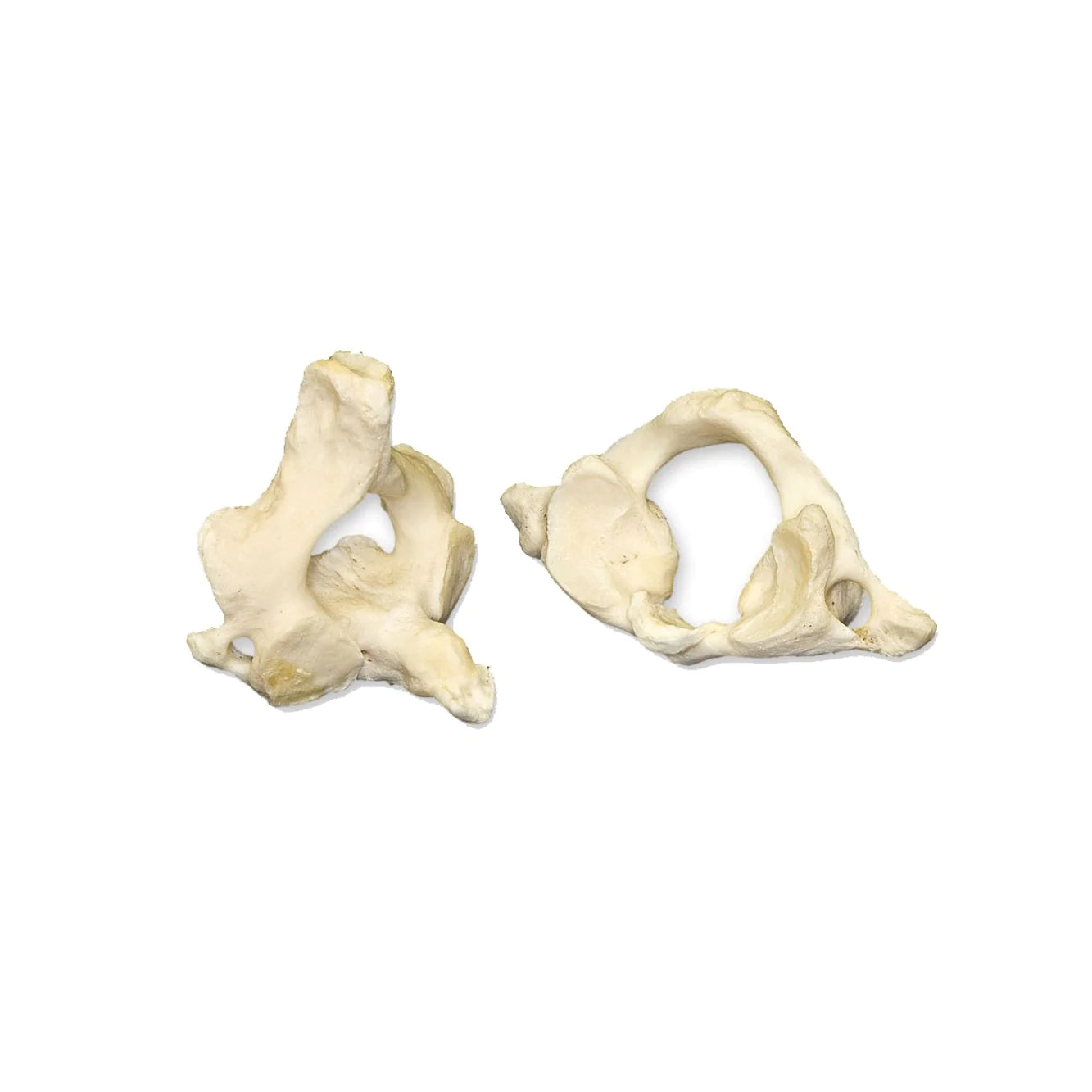 Premium Human Vertebrae Specimen for Medical Research & Education - Ideal for Anatomy Study, Medical Training, and Forensic Science Applications