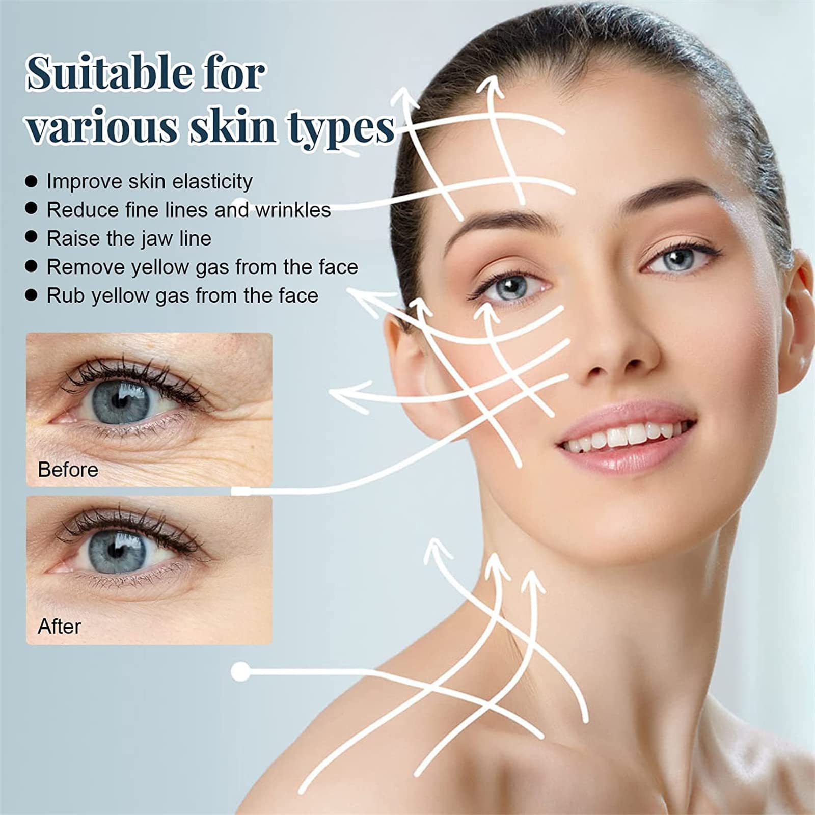Proform Korean Soluble Protein Threads - 60pcs Face Lift Kit for Instant Lifting