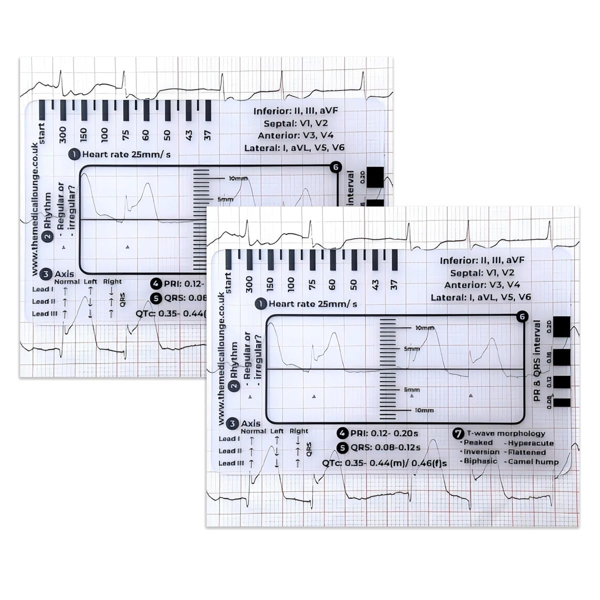 7-Step ECG Ruler for EKG Interpretation - Transparent Plastic Measuring Tool with Calipers, Portable Medical Reference Guide (2-Pack) - Perfect for Nurses, Medical Students & Healthcare Professionals