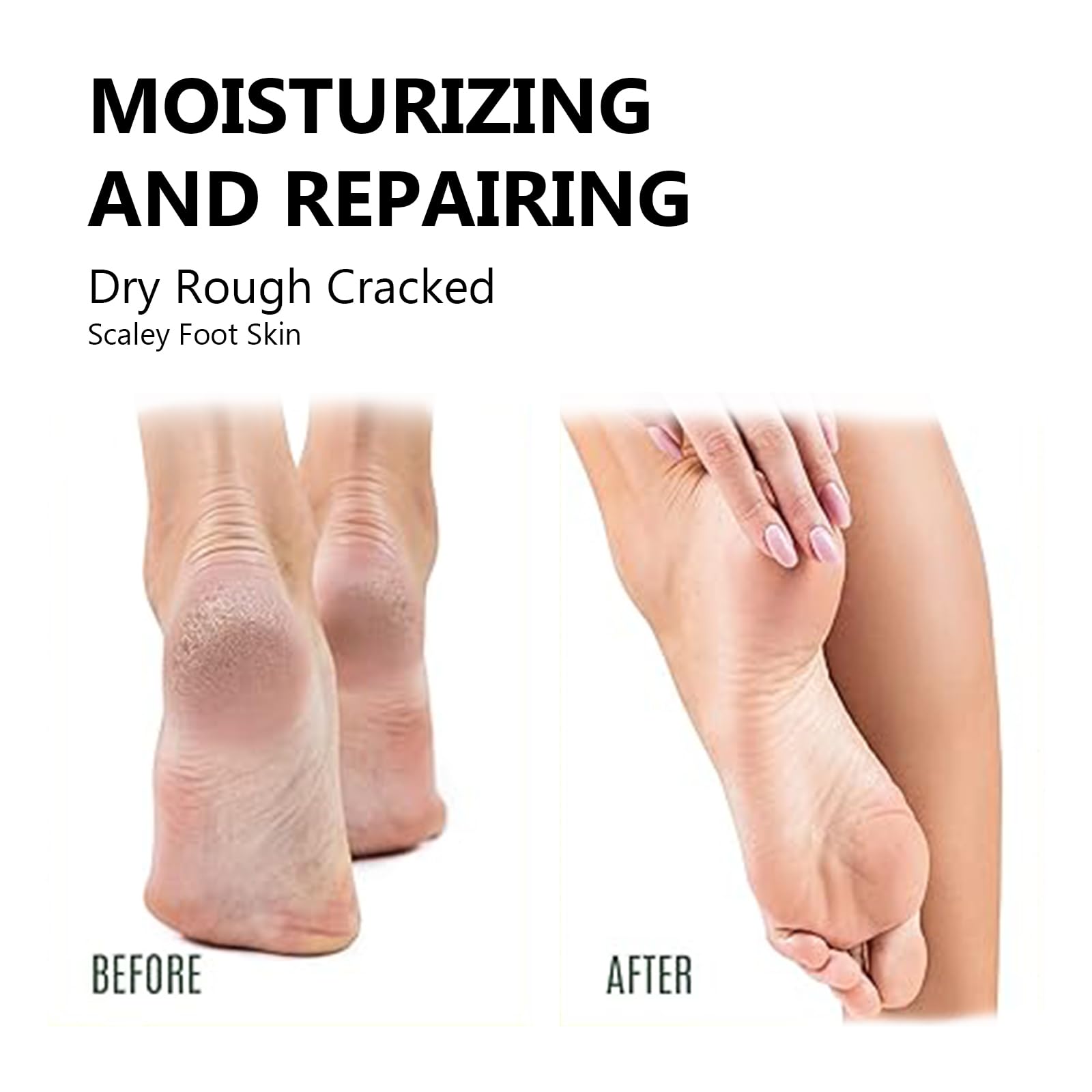 40% Urea & 2% Salicylic Acid Foot Cream for Dry Cracked Heels - Intense Moisturizing Treatment for Feet, Knees, Elbows & Hands | Professional Pedicure Supplies for Soft Smooth Skin at Home