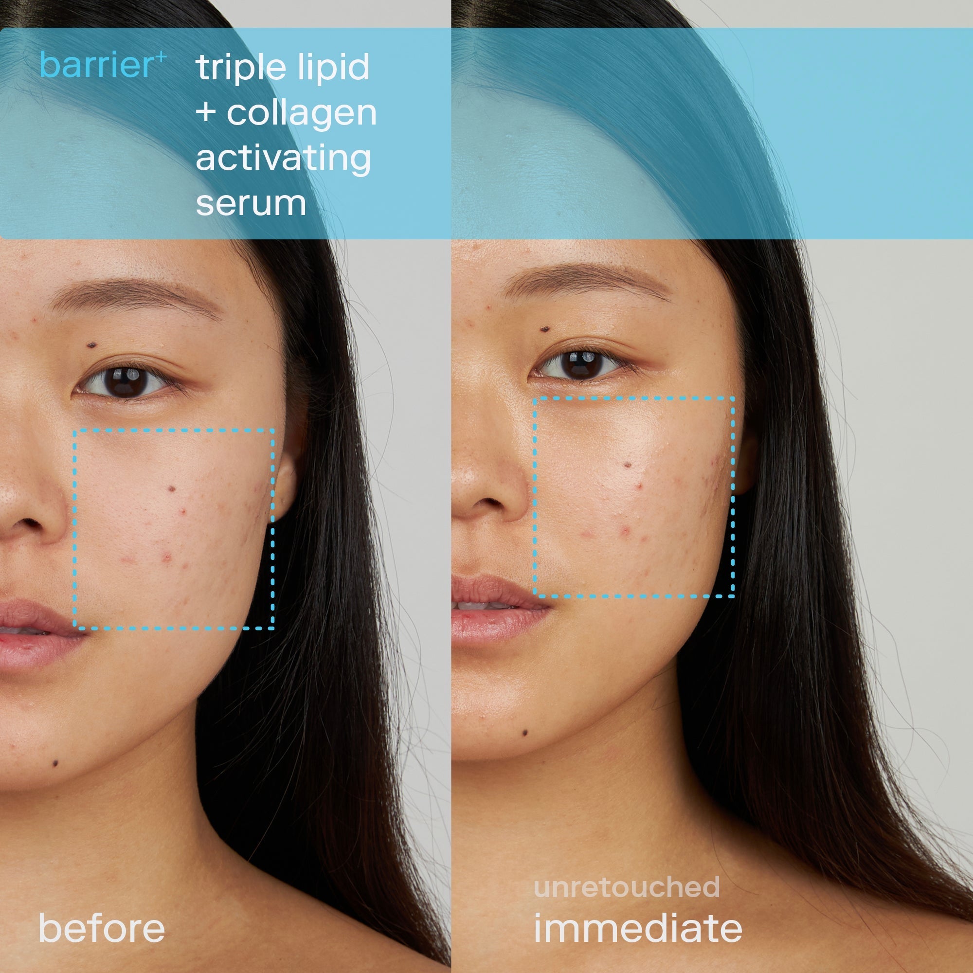 Barrier+ Triple Lipid Activating Serum for Face - Anti-Aging Hydrating Facial Treatment - Day & Night Moisturizer for Dry, Sensitive Skin | Perfect for Daily Skincare Routine & Post-Procedure Care