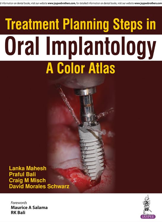 Oral Implantology Treatment Planning Steps: Color Atlas Guide for Dental Professionals - Perfect for Dental Clinics, Implant Procedures & Student Education
