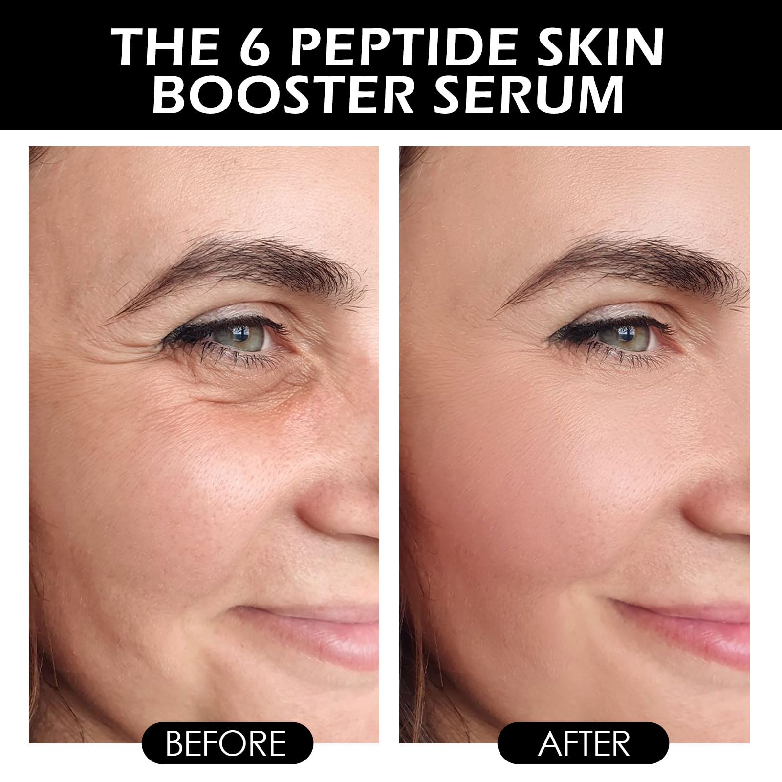 Skin Booster Serum for Even Skin Tone & Hydration | Pore Minimizer & Sebum Control | Improves Skin Texture, Firmness & Smoothness (2-Pack) | Perfect for Daily Skincare Routine & Nighttime Skin Repair