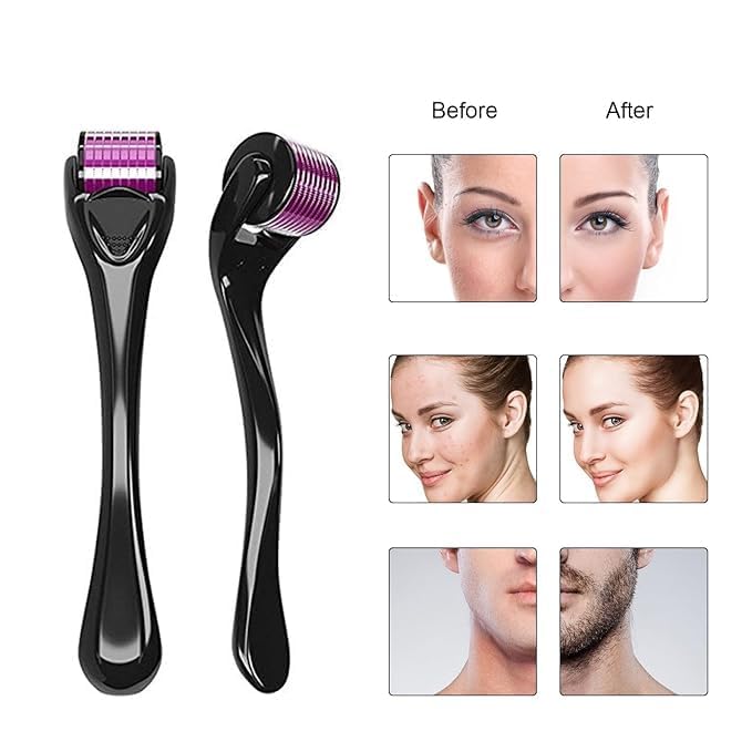 ALM Roller 0.5mm with 540 Titanium Needles for Hair Growth & Scalp Care | Hair Regrowth Treatment for Thinning Hair & Hair Loss | Reduces Acne Scars | Safe & Effective Derma Roller for Home Use | Perfect for Hair Care Routine & Skin Rejuvenation