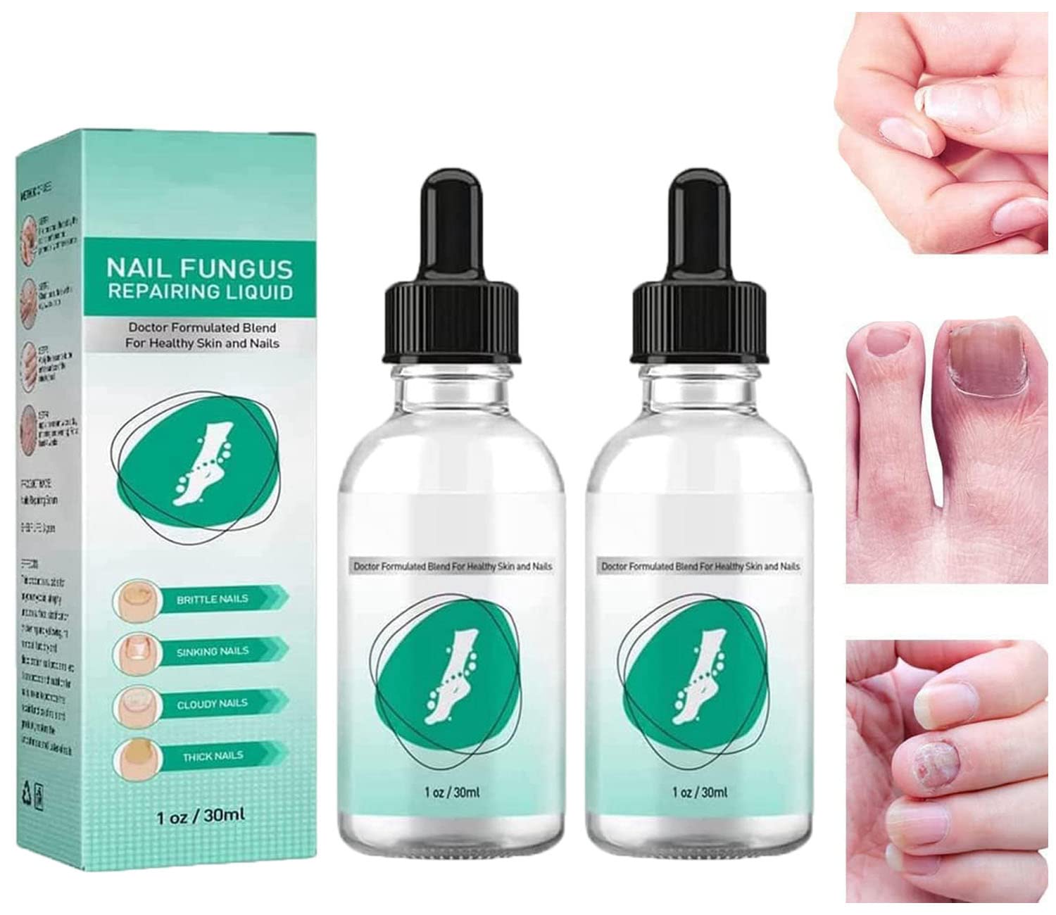 Kerassentials Natural Toenail Fungus Treatment Oil - Repair Damaged & Discolored Nails - 2 Pack - Fast-Acting Antifungal Formula for Healthy Nails - Perfect for Athletes, Swimmers & Daily Foot Care