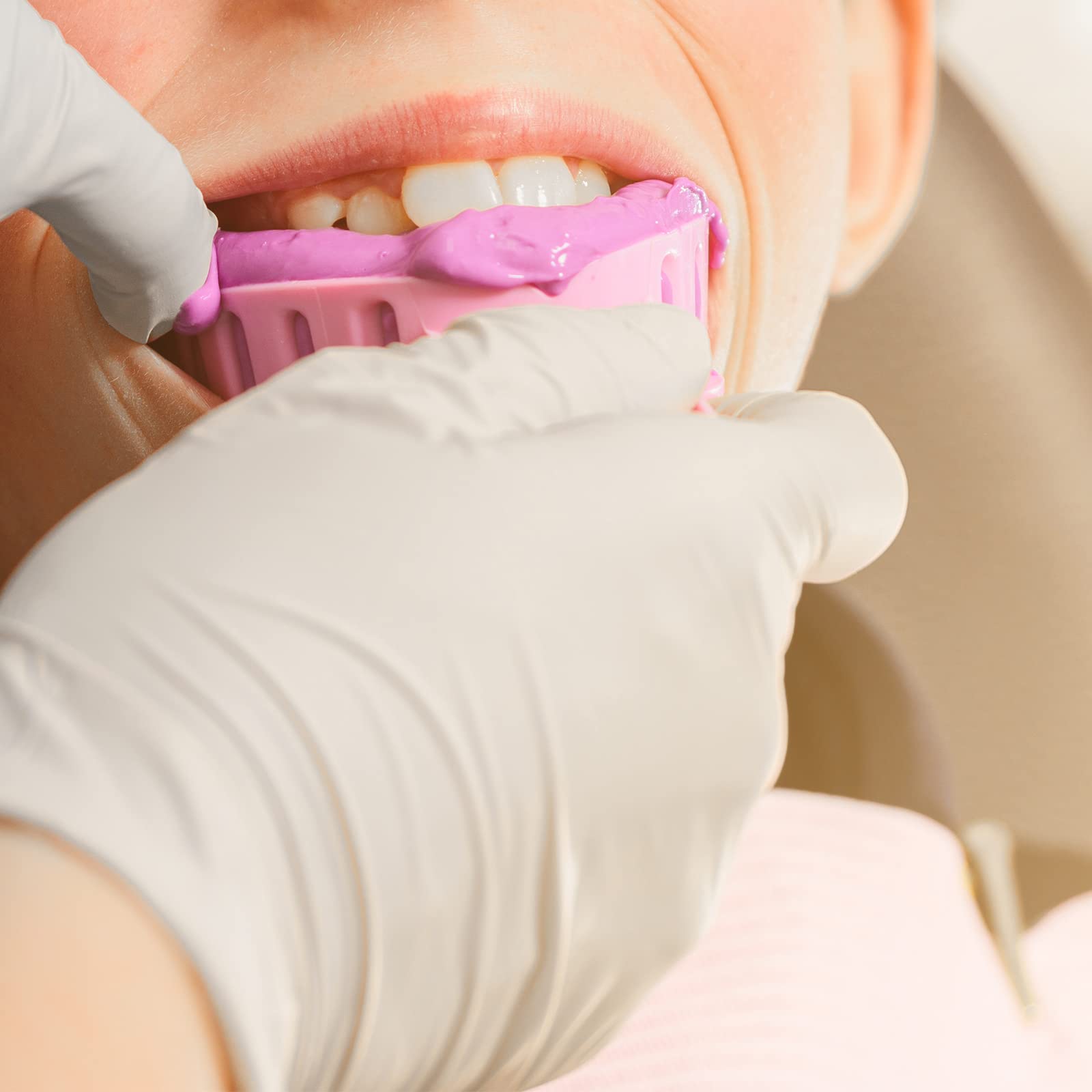 JMU Full Arch Bite Registration Trays 30 Pcs - Disposable Dental Impression Trays for Teeth Models (Pink) - Perfect for Dentists, Orthodontists & Dental Labs for Accurate Bite Registration & Impressions
