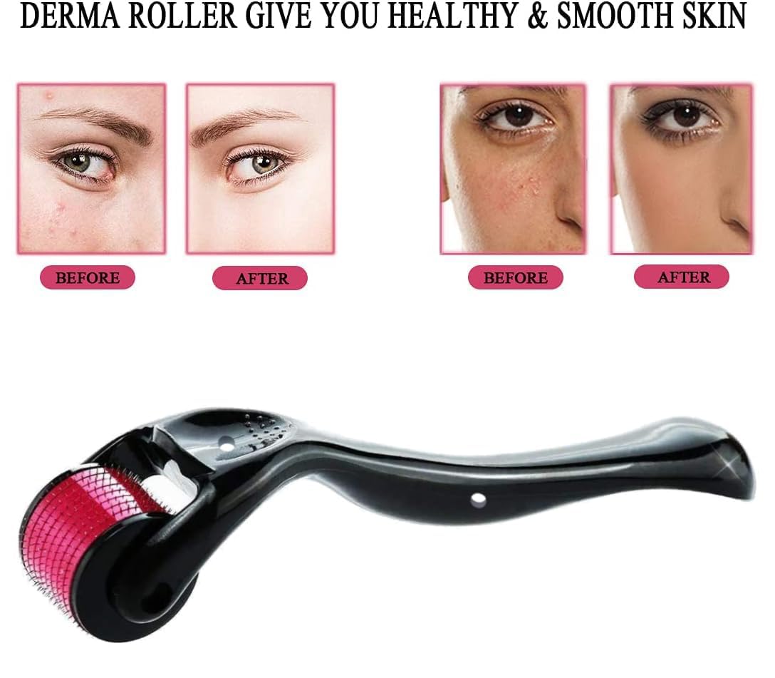 ALM Roller 0.5mm with 540 Titanium Needles for Hair Growth & Scalp Care | Hair Regrowth Treatment for Thinning Hair & Hair Loss | Reduces Acne Scars | Safe & Effective Derma Roller for Home Use | Perfect for Hair Care Routine & Skin Rejuvenation