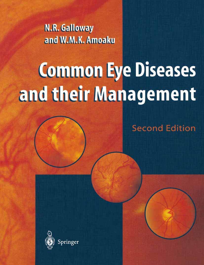 Common Eye Diseases and Their Treatments - Symptoms, Causes & Prevention Tips for Healthy Vision | Perfect for Home Care, Clinics & Optometry Practices