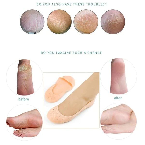 Dabster Anti Crack Heel Silicone Gel Foot Protector Socks - Moisturizing & Pain Relief for Cracked Feet, Heel Pads for Women - Perfect for Overnight Foot Care, Dry Skin Repair & Comfortable Daily Wear