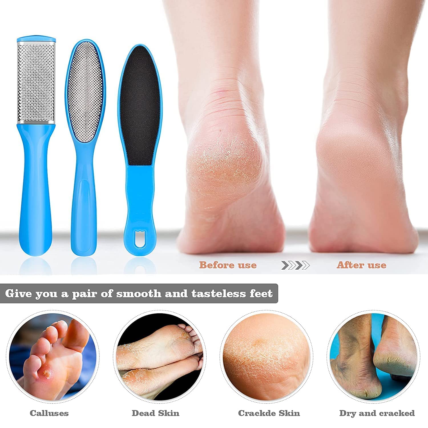 HUDACRUSH 8-in-1 Professional Pedicure Kit for Soft Feet - Callus Remover, Foot Scrubber, Nail File & More - Perfect for Home Spa, Pedicure & Foot Care Routine