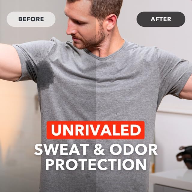 SweatBlock Clinical Strength Antiperspirant Wipes for Hyperhidrosis - 7 Days Sweat Protection per Wipe - Dermatologist Tested for Men, Women & Teens - 30 Count Pack - Ideal for Gym, Work & Social Events