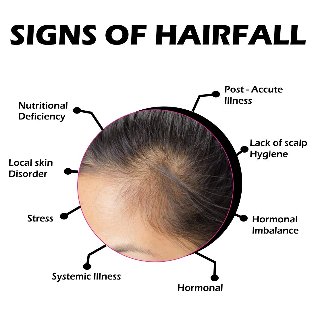 Glamlives Hair Growth Shampoo - Anti Hair Fall Treatment for Thicker, Stronger Hair (100ml) | Daily Use for Damaged & Thinning Hair