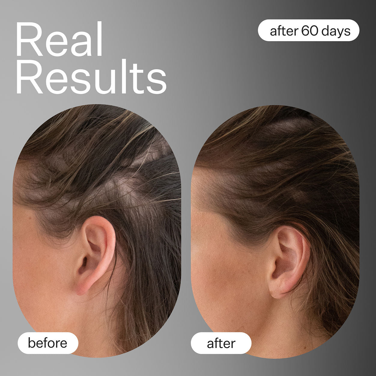 Professional Dermaroller Hair Growth System for Men & Women - Microneedling Scalp Roller for Thicker, Healthier Hair - At-Home Hair Regrowth Treatment for Thinning Hair & Hair Loss - Perfect for Daily Hair Care Routine