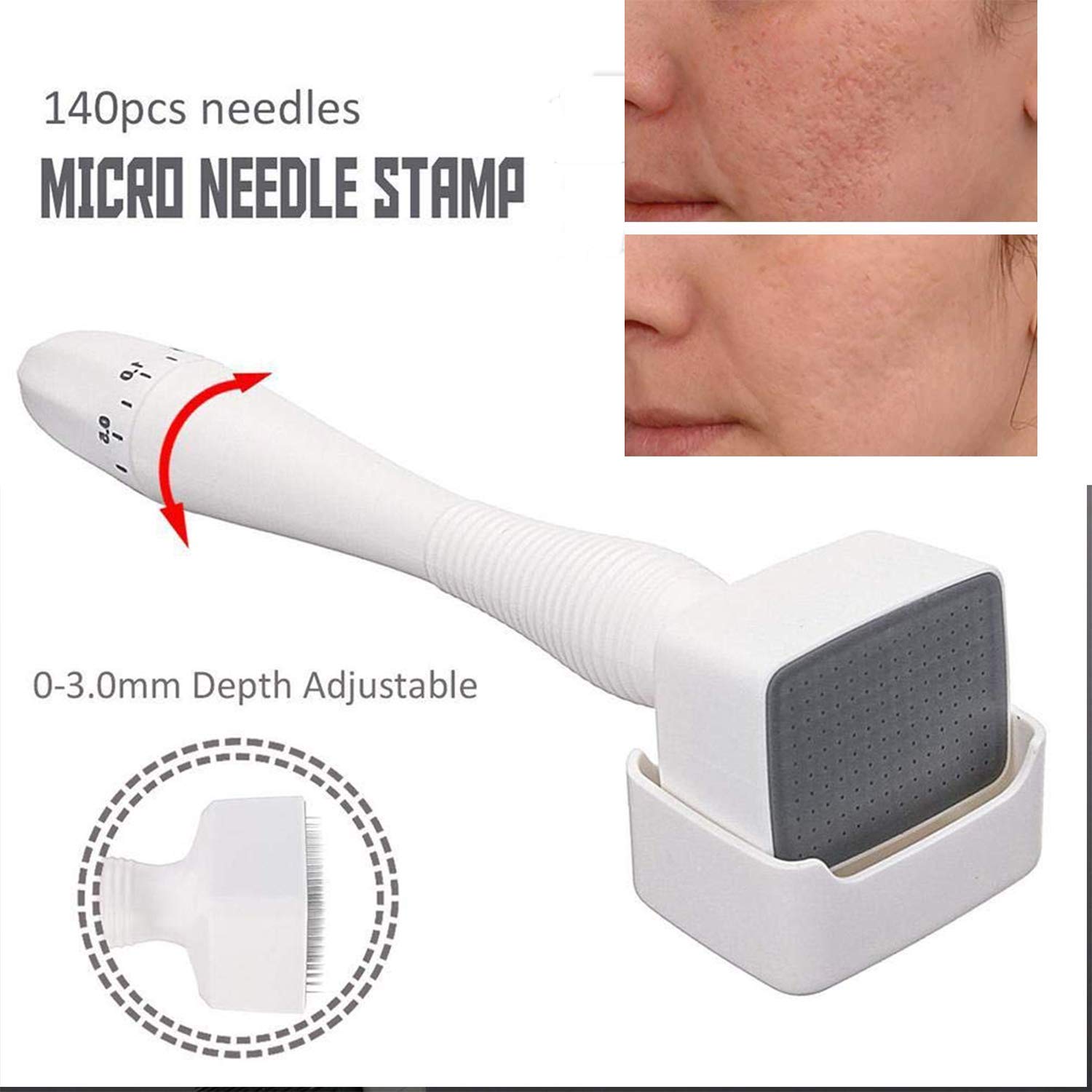 Professional Titanium Derma Stamp 140 Needles - INCELLICE Microneedle Stamp for Hair Growth & Beard Care | Facial Skin Rejuvenation for Men & Women | Perfect for At-Home Hair Regrowth & Anti-Aging Skincare Routine