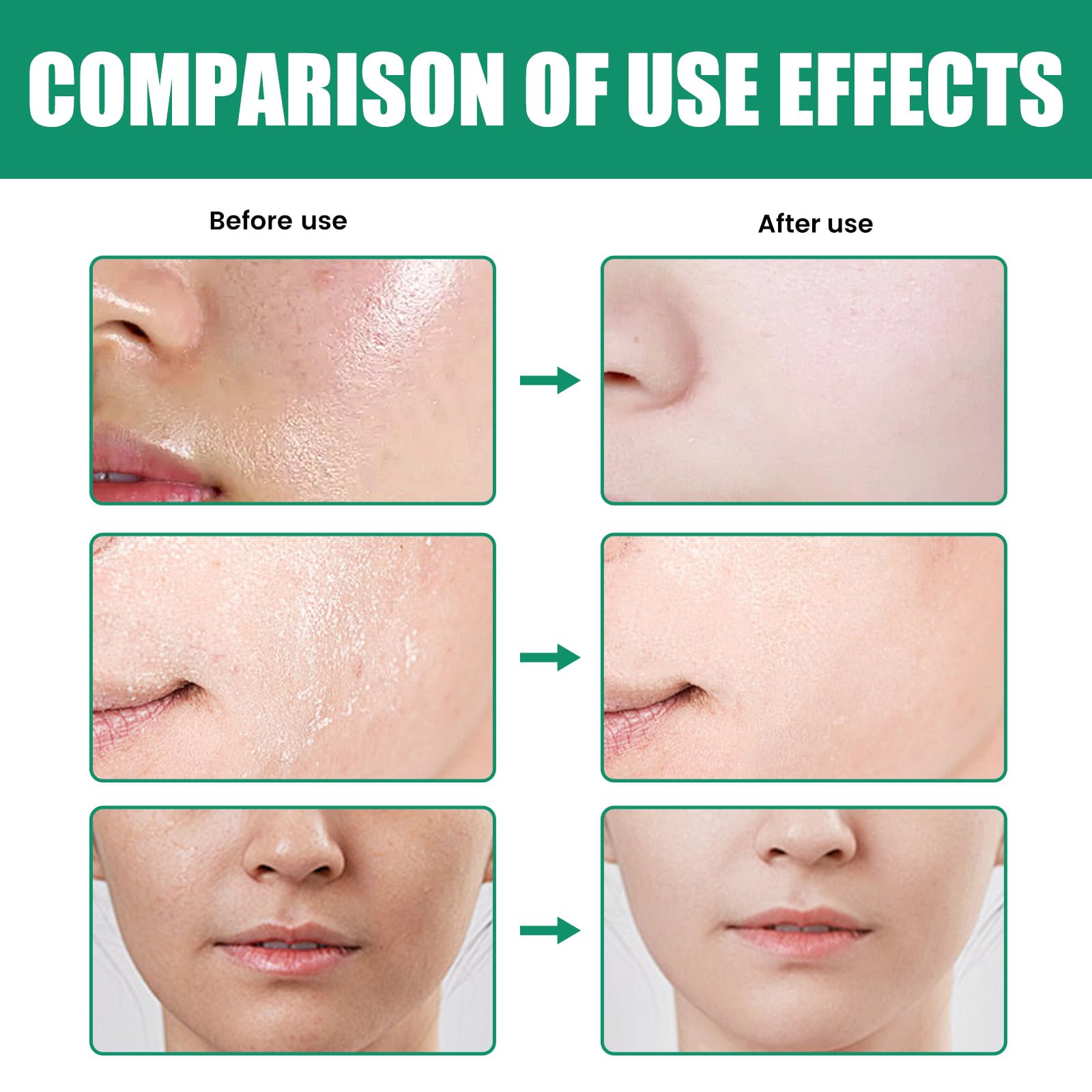 Lisade Centella Facial Cleanser - Deep Cleansing Oil Control Face Wash for Acne Prone Skin | Gentle Pore Minimizer & Hydrating Face Wash Cream | Soothing Facial Cleanser for Daily Skincare Routine & Morning/Evening Use