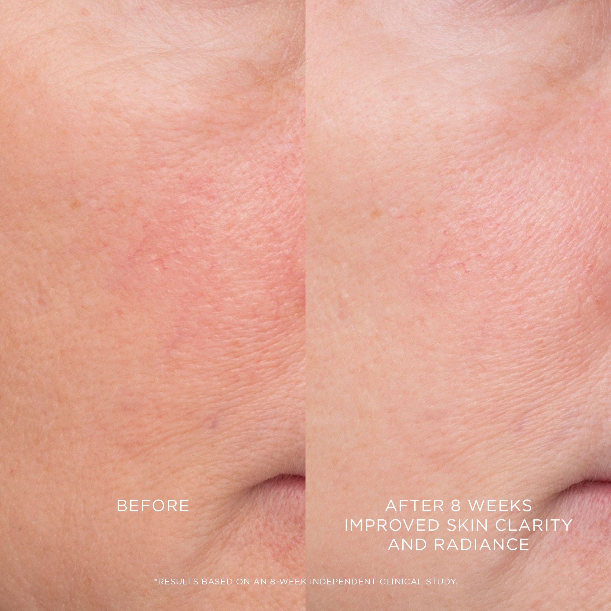Equilibrium Resurfacing Retinoid Treatment for Face - Anti-Aging Skincare Cream with Retinol for Wrinkles & Fine Lines - Perfect for Nighttime Routine & Dry Skin Care