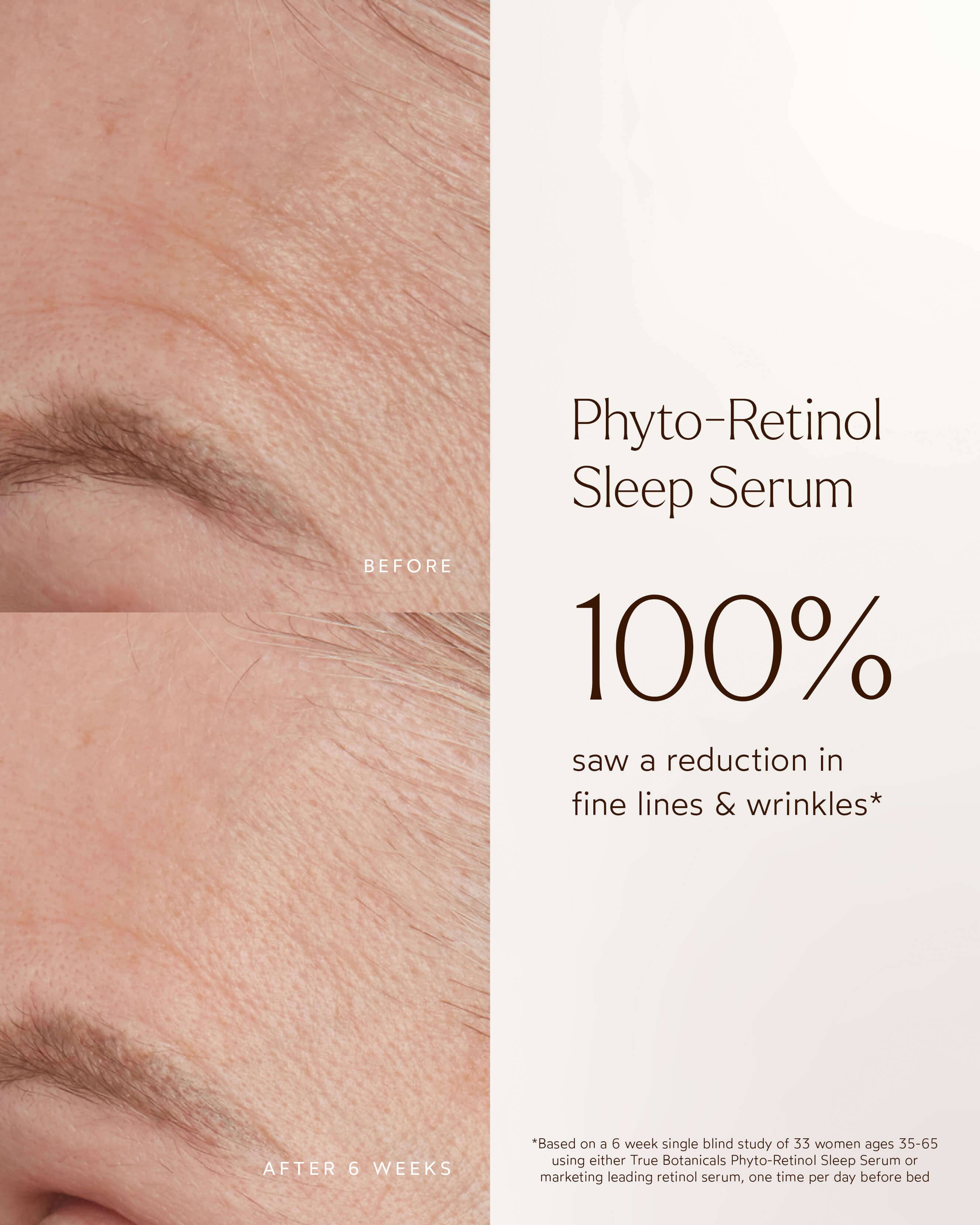Phyto Retinol Anti-Aging Night Serum for Wrinkles & Fine Lines | Hydrating Overnight Face Treatment for Youthful Skin | Perfect for Nighttime Skincare Routine